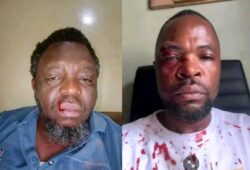 Lomami : Deux députés provinciaux dans le viseur de la justice après une violente altercation