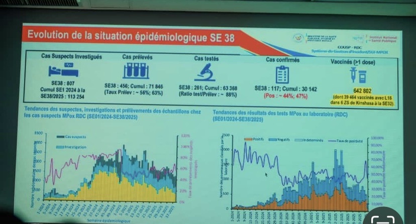Triple Alerte Sanitaire en RDC : Mobilisation Totale Contre Ebola, Mpox et Choléra